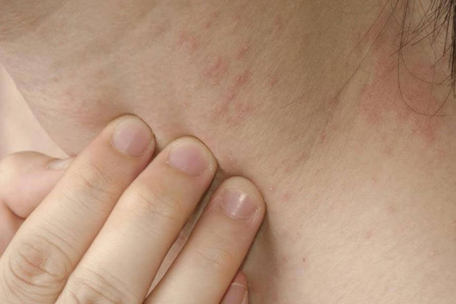Заболевания кожи у ребенка